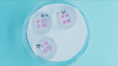 Strasbourg scientifique test bactérie